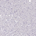 Immunohistochemical staining of human liver shows no positivity in hepatocytes as expected.