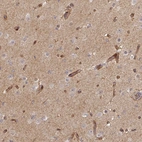 Immunohistochemical staining of human cerebral cortex shows moderate cytoplasmic positivity in neuropil and endothelial cells.