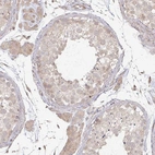 Immunohistochemical staining of human testis shows moderate cytoplasmic positivity in cells in seminiferous ducts and Leydig cells.