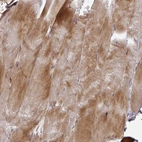Immunohistochemical staining of human skeletal muscle shows moderate cytoplasmic positivity in myocytes.