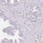 Immunohistochemical staining of human prostate shows no cytoplasmic positivity in glandular cells as expected.