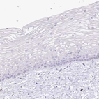 Immunohistochemical staining of human cervix, uterine shows no cytoplasmic positivity in squamous epithelial cells as expected.