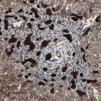 Immunohistochemical staining of human liver shows strong cytoplasmic positivity in cholangiocytes.