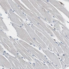 Immunohistochemical staining of human skeletal muscle shows no cytoplasmic positivity in myocytes as expected.