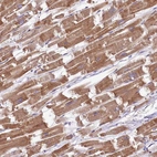 Immunohistochemical staining of human heart muscle shows strong cytoplasmic positivity in cardiomyocytes.