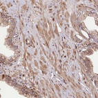 Immunohistochemical staining of human prostate shows moderate cytoplasmic positivity in smooth muscle cells.