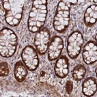 Immunohistochemical staining of human rectum shows strong cytoplasmic positivity in glandular cells.