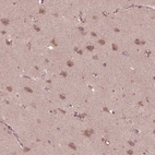 Immunohistochemical staining of human cerebral cortex shows moderate cytoplasmic positivity in neuronal cells and neuronal processes.