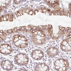 Immunohistochemical staining of human colon shows strong cytoplasmic positivity in glandular cells.