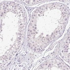 Immunohistochemical staining of human testis shows no cytoplasmic positivity in cells in seminiferous ducts as expected.