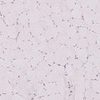Immunohistochemical staining of human skeletal muscle shows no cytoplasmic positivity in myocytes as expected.