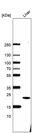 Western blot analysis in human liver tissue.