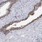 Immunohistochemical staining of human prostate shows strong cytoplasmic and nuclear positivity in glandular cells.