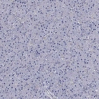 Immunohistochemical staining of human pancreas shows no cytoplasmic positivity in exocrine glandular cells as expected.