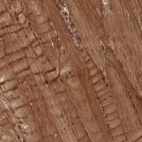 Immunohistochemical staining of human skeletal muscle shows strong cytoplasmic positivity in myocytes.