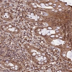 Immunohistochemical staining of human rectum shows strong cytoplasmic positivity in lymphoid cells and glandular cells.
