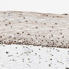 Immunohistochemical staining of human uterine cervix shows moderate positivity in squamous epithelial cells.
