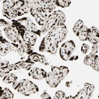 Immunohistochemical staining of human placenta shows strong nuclear positivity in trophoblastic cells.