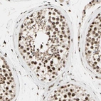 Immunohistochemical staining of human testis shows moderate nuclear positivity in cells in seminiferous ducts.
