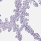 Immunohistochemical staining of human prostate shows no membranous positivity in glandular cells as expected.
