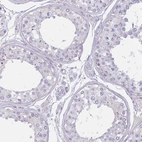 Immunohistochemical staining of human testis shows no membranous positivity in cells in seminiferous ducts as expected.