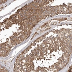 Immunohistochemical staining of human testis shows strong cytoplasmic positivity in cells in seminiferous ducts.