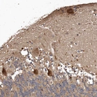 Immunohistochemical staining of human cerebellum shows strong cytoplasmic positivity in Purkinje cells.
