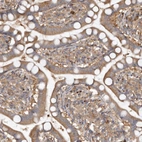 Immunohistochemical staining of human intestine shows moderate cytoplasmic positivity in glandular cells.