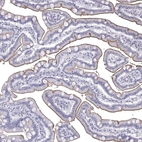 Immunohistochemical staining of human duodenum shows strong positivity in apical membrane in glandular cells.