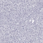 Immunohistochemical staining of human liver shows no membranous positivity in hepatocytes as expected.