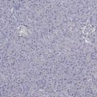 Immunohistochemical staining of human pancreas shows no membranous positivity in exocrine glandular cells as expected.