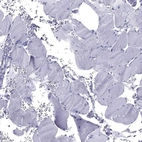 Immunohistochemical staining of human skeletal muscle shows no membranous positivity in myocytes as expected.