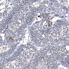 Immunohistochemical staining of human testis shows moderate cytoplasmic positivity in Leydig cells.
