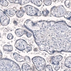 Immunohistochemical staining of human placenta shows no cytoplasmic positivity in trophoblastic cells as expected.