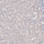 Immunohistochemical staining of human liver shows no cytoplasmic positivity in hepatocytes as expected.