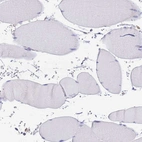Immunohistochemical staining of human skeletal muscle shows no positivity in myocytes as expected.