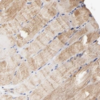 Immunohistochemical staining of human skeletal muscle shows moderate cytoplasmic positivity in myocytes.