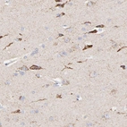 Immunohistochemical staining of human cerebral cortex shows strong cytoplasmic /cytoplasmic granular positivity in neuronal cells.