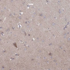 Immunohistochemical staining of human cerebral cortex shows moderate cytoplasmic positivity in subset of neurons.