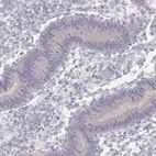 Immunohistochemical staining of human endometrium shows no positivity in glandular cells.