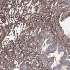 Immunohistochemical staining of human endometrium shows strong cytoplasmic positivity in stromal cells.