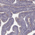 Immunohistochemical staining of human fallopian tube shows strong cytoplasmic positivity in cilliated cells.
