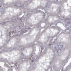 Immunohistochemical staining of human kidney shows no positivity in cells in tubules.