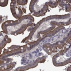 Immunohistochemical staining of human duodenum shows strong membranous-cytoplasmic positivity in glandular cells.