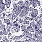 Immunohistochemical staining of human placenta shows no positivity in trophoblastic cells.