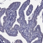 Immunohistochemical staining of human fallopian tube shows no positivity in glandular cells.