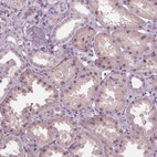 Immunohistochemical staining of human kidney shows moderate nuclear/nucleoli positivity in cells in tubules.