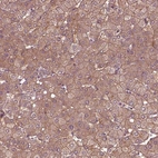 Immunohistochemical staining of human liver shows moderate membranous-cytoplasmic positivity in hepatocytes.
