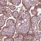 Immunohistochemical staining of human placenta shows moderate membranous-cytoplasmic positivity in trophoblastic cells.