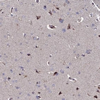 Immunohistochemical staining of human cerebral cortex shows strong nuclear positivity in neuronal cells with additional cytoplasmic positivity.